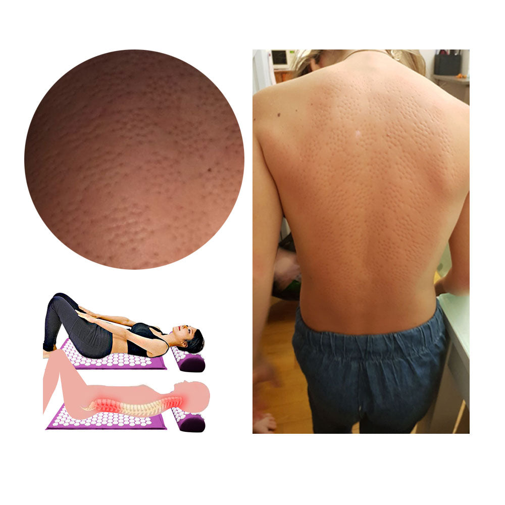 Bequeme Akupressurmatte für Unisex Entspannung Schmerztherapie Zuhause 3